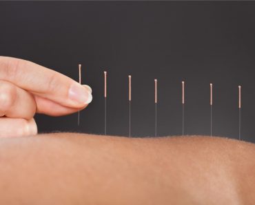 ¿Es útil la acupuntura para el tratamiento del cólico del lactante?
